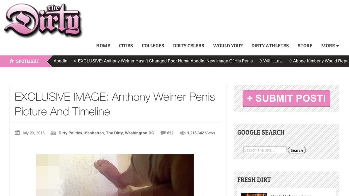 Bilder på Weiners penis dök upp i somras på TheDirty.com.